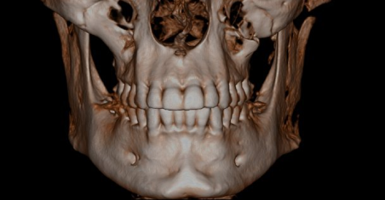 sondage cone beam