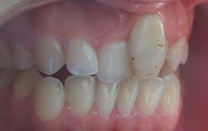 nahon02-1024x644