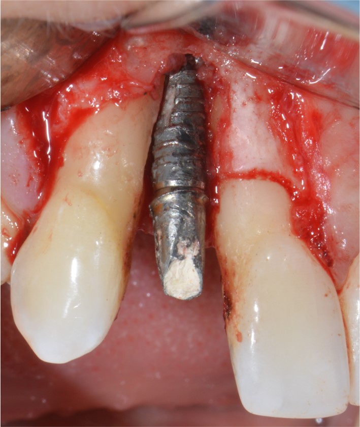 Image4