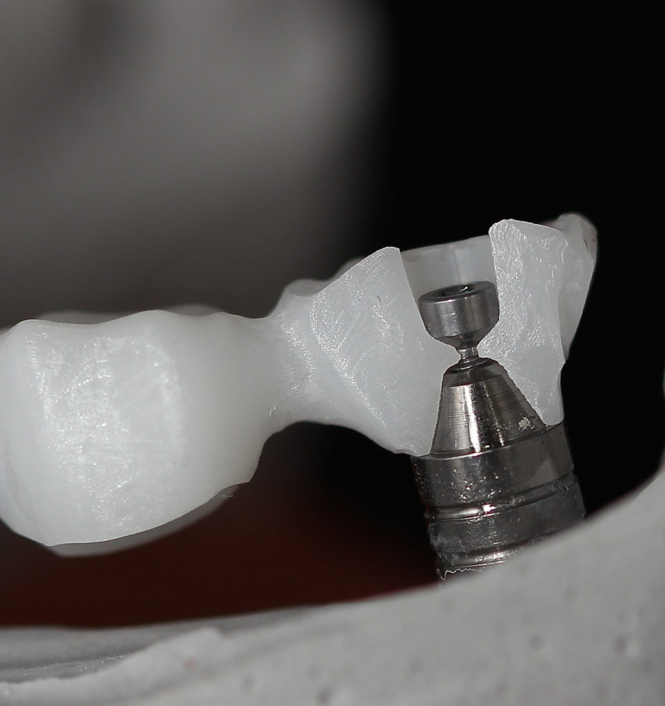 Photo 10 : Coupe d’une armature réalisée en interne. Travaux du laboratoire DECHE