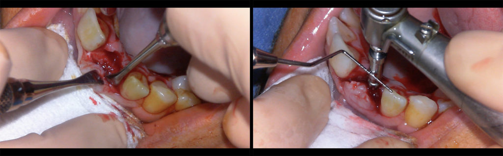 Fig 7 et 8