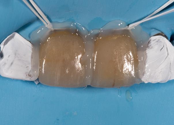 Application de gel glycériné.
