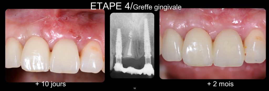 Diapositive18