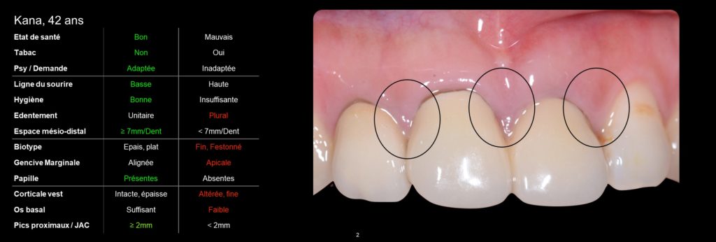 Diapositive2