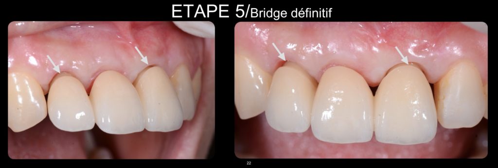 Diapositive22