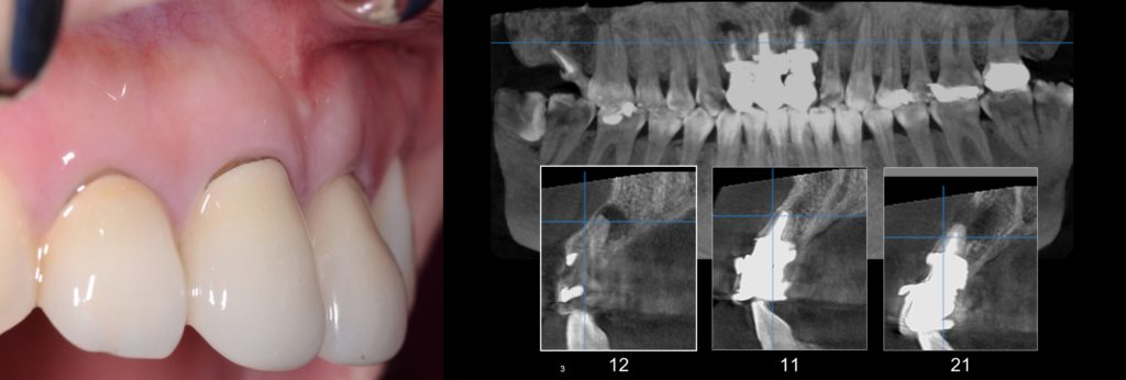 Diapositive3