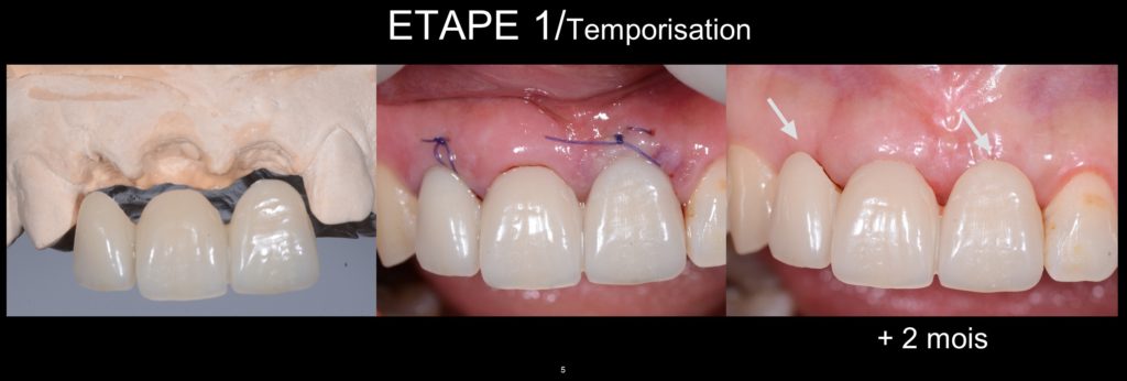 Diapositive5