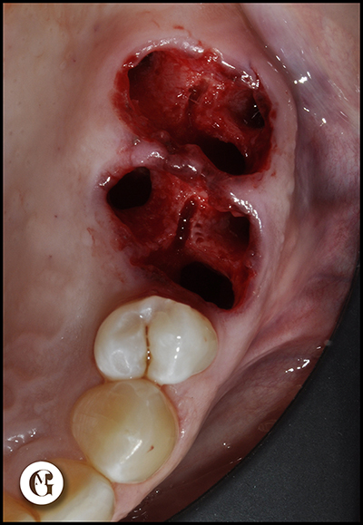 figure6