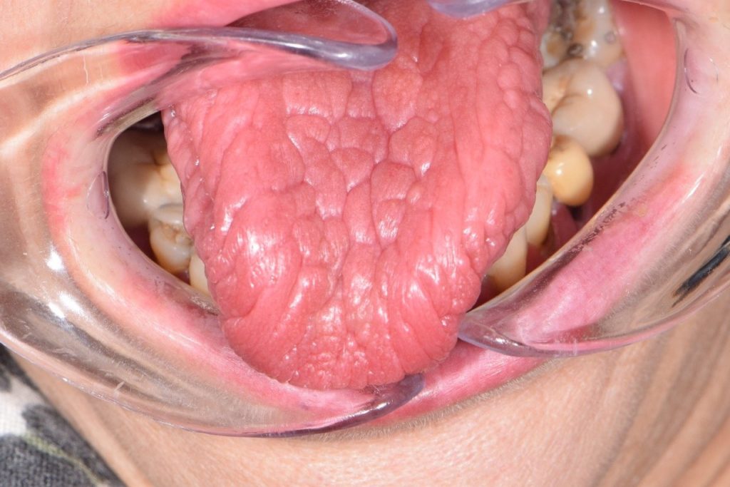 Fig 1