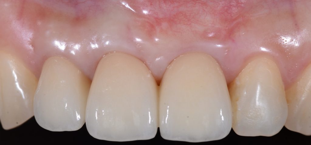 Image1