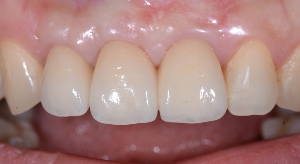 Image2