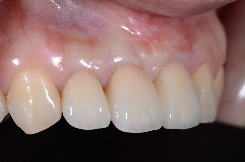 Image3