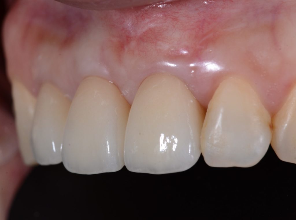 Image4