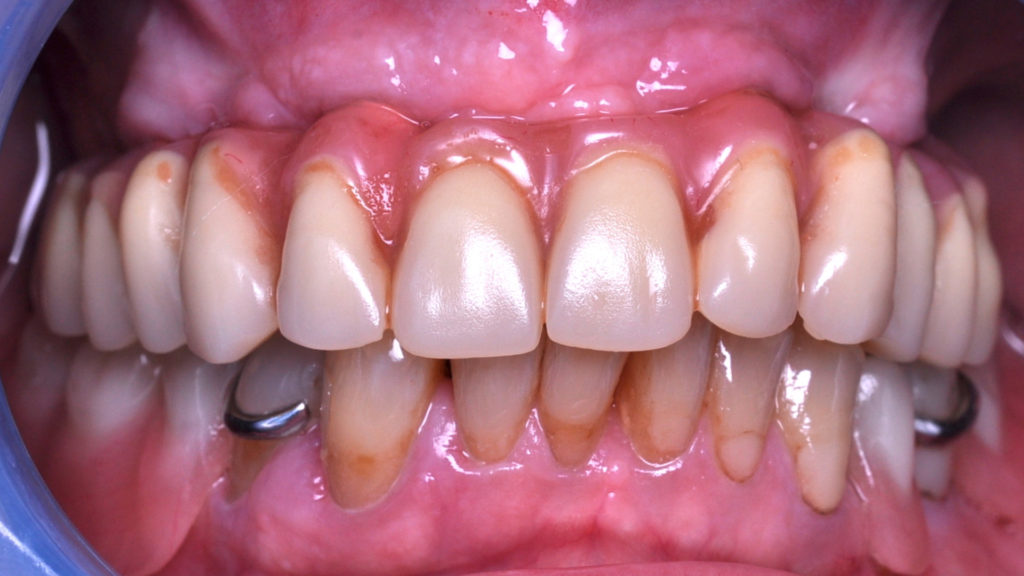 Fig 8