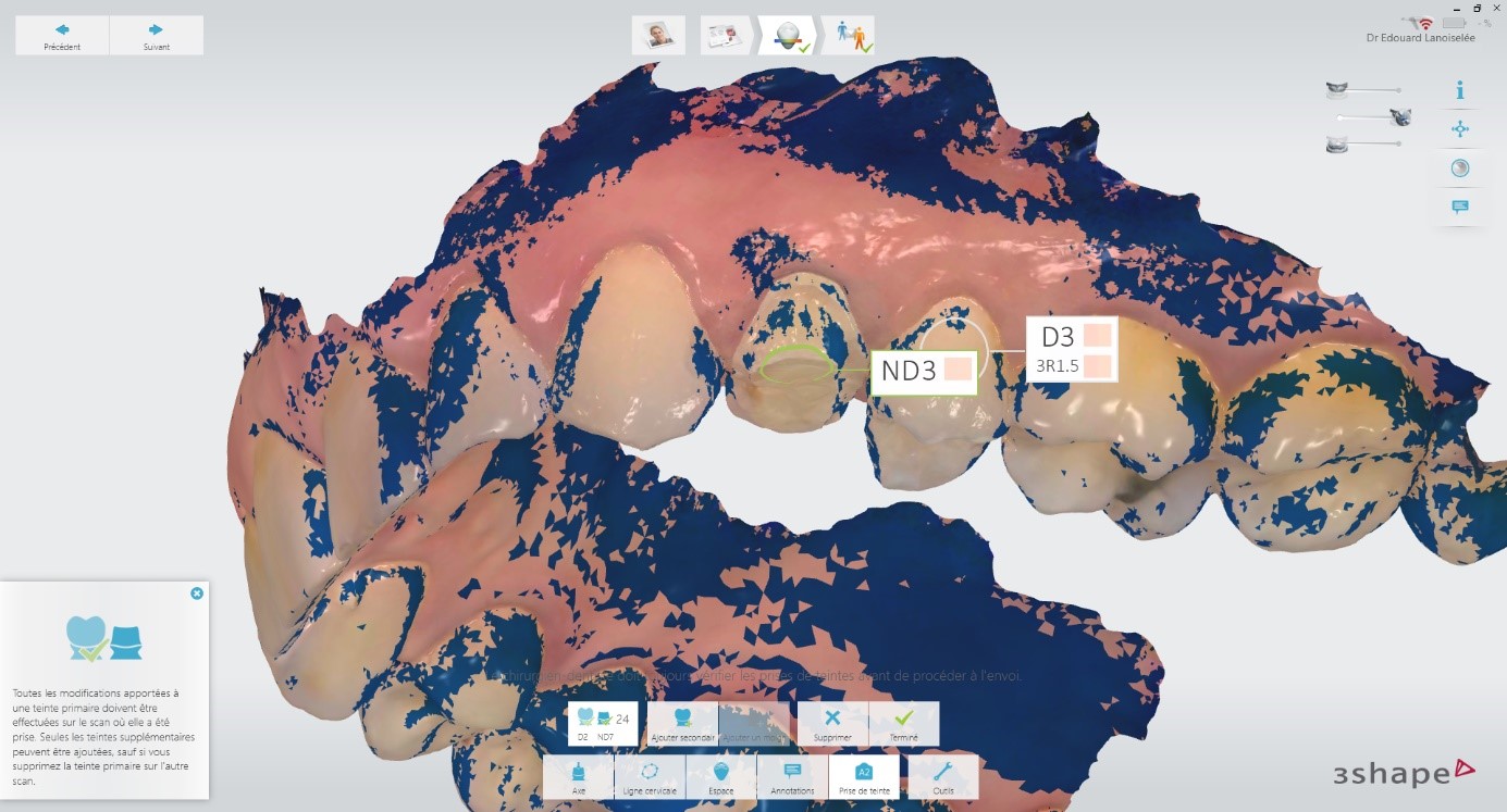 empreinte 3shape