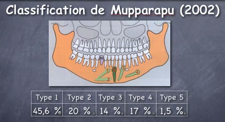 Mupparapu