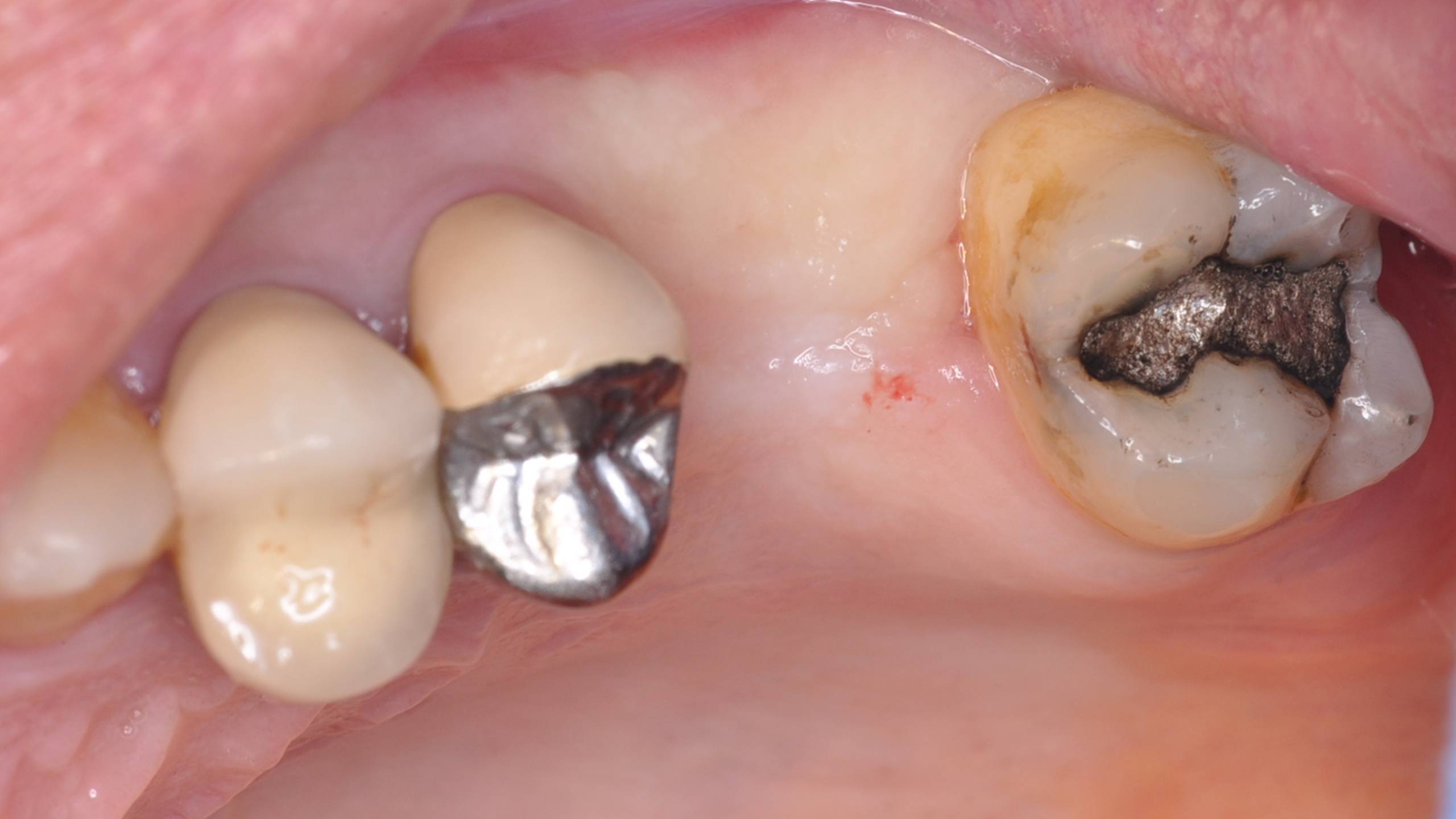 Diapositive14