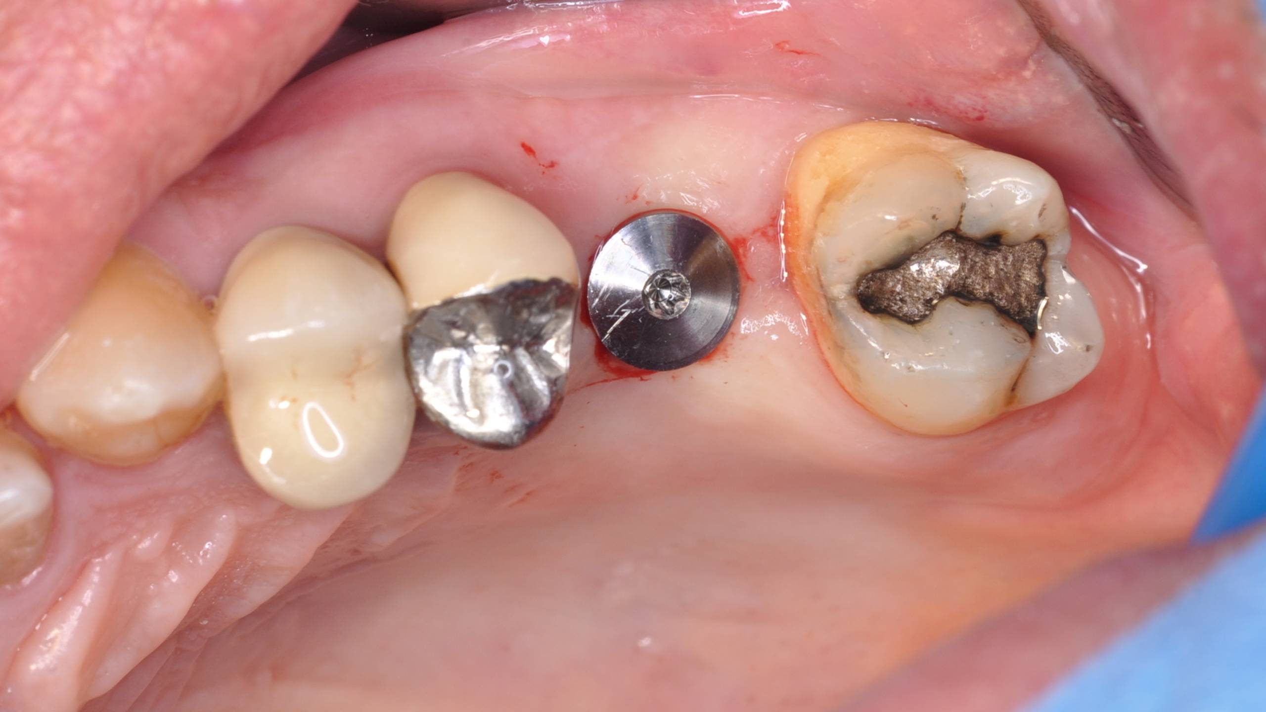Diapositive18