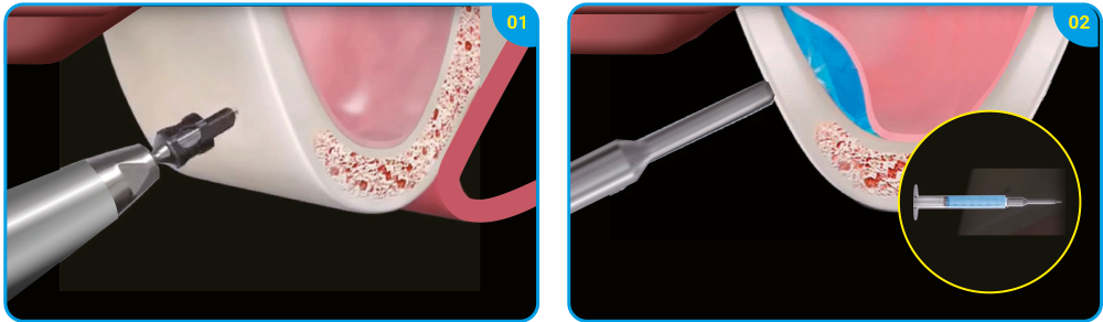 Fig 04