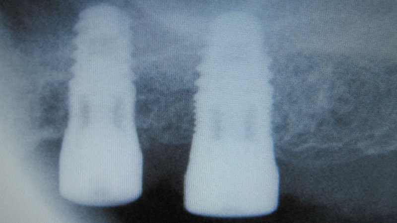 Diapositive33