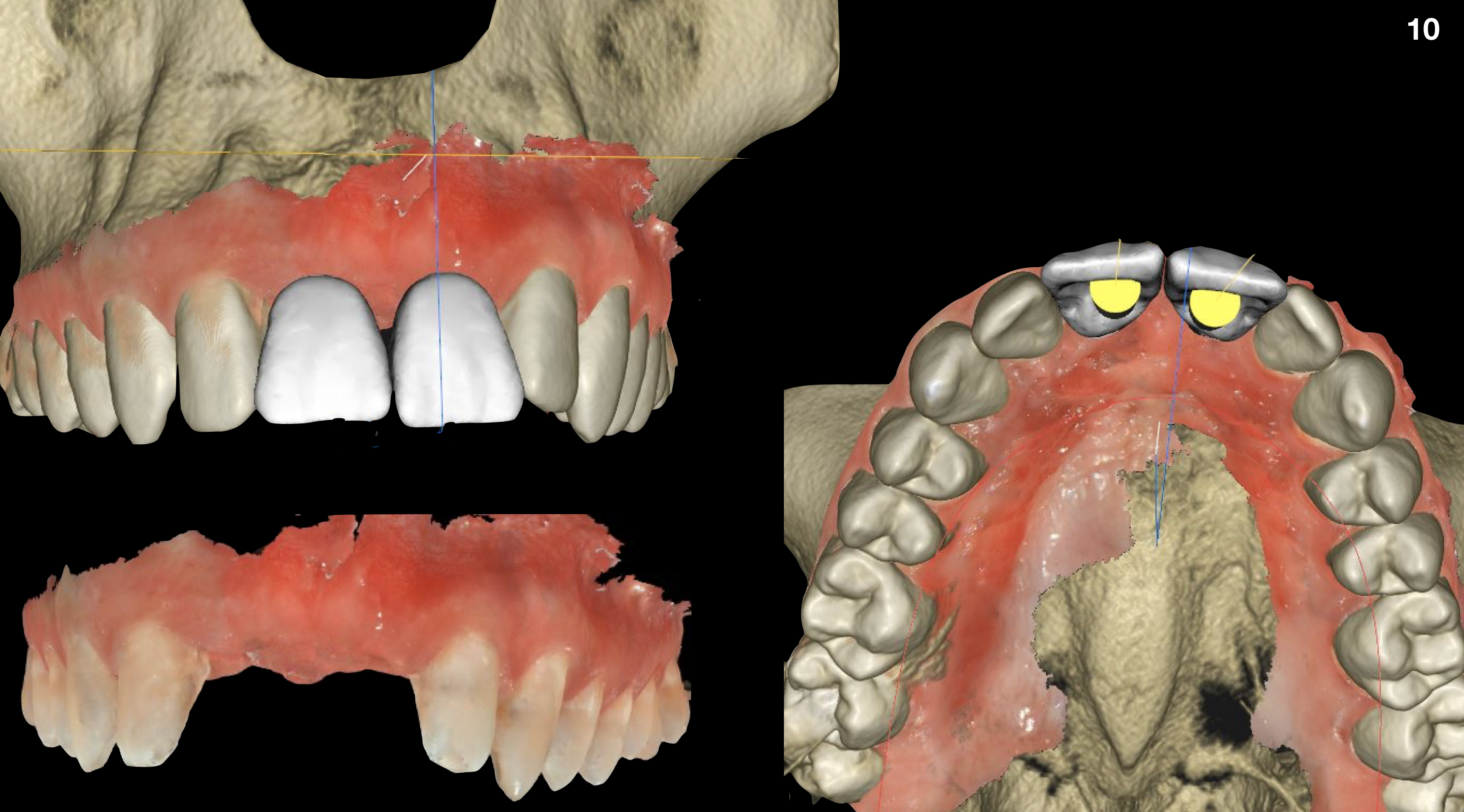 FIgure 10
