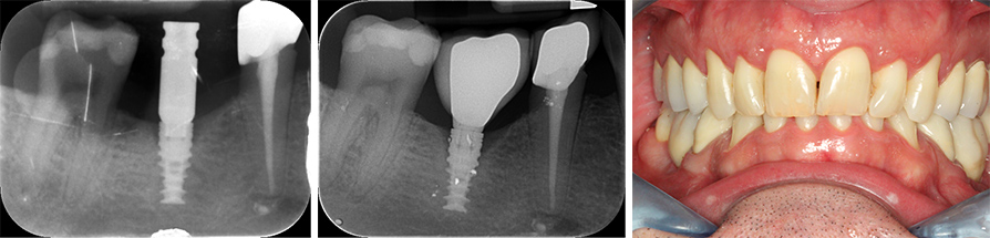 Fig 07-08-09