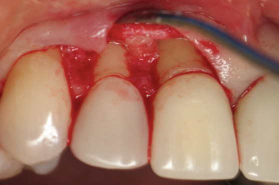 Image2