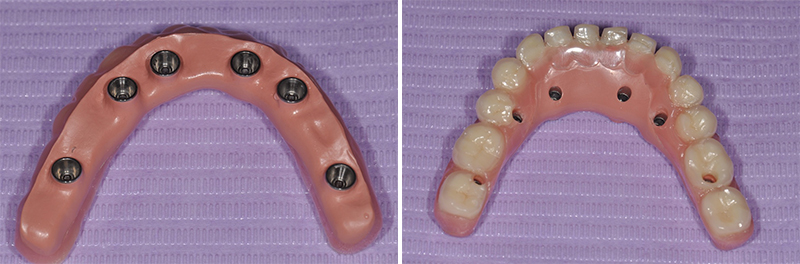 Fig-26-27