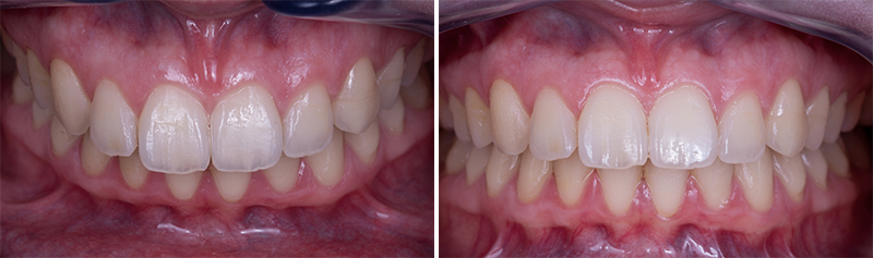 Fig. 2a et 2b