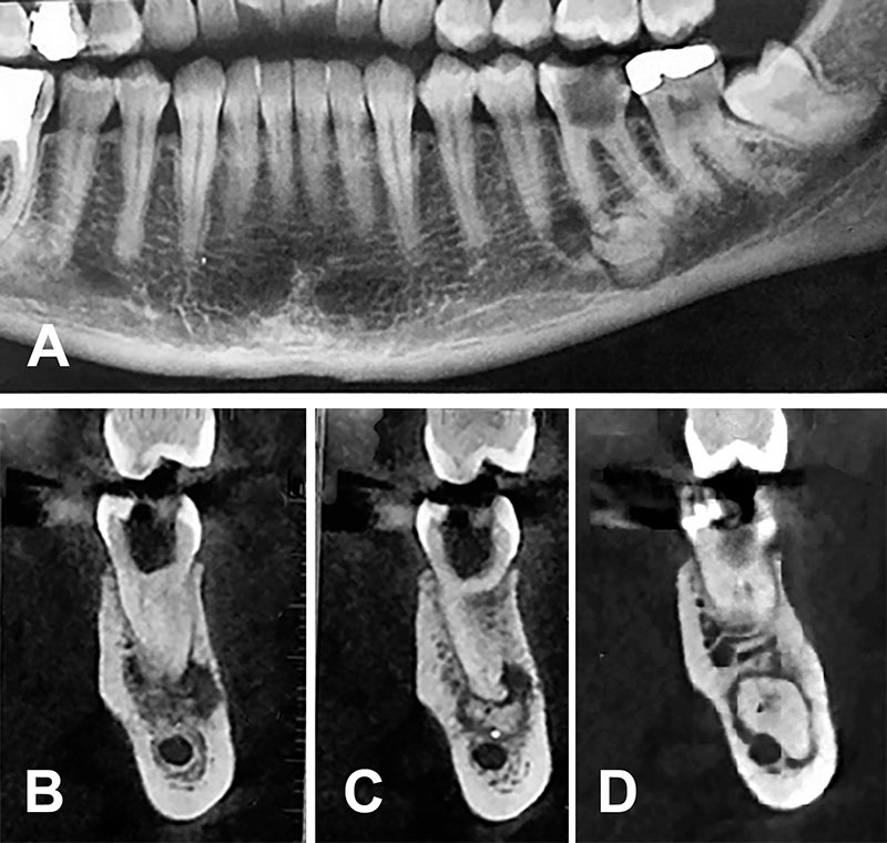 Figure-1-Mme-A-1cas