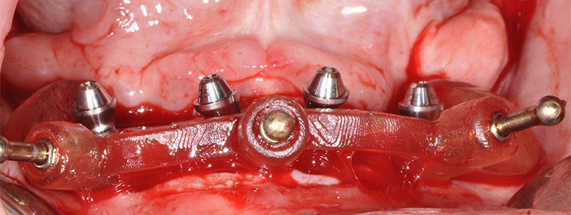 Fig-29