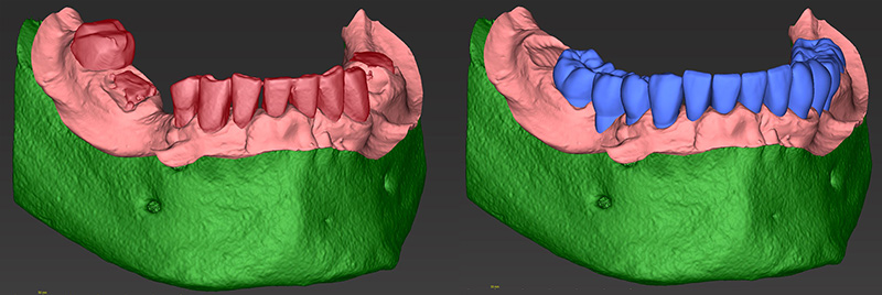 Fig-41-42