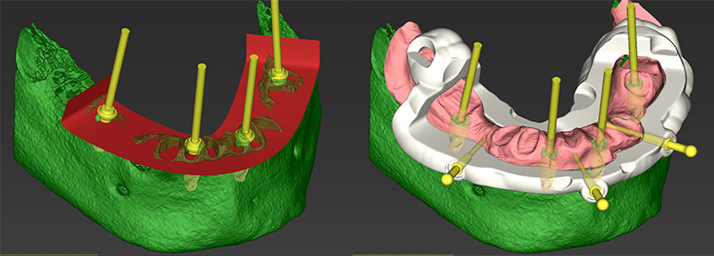 Fig-44-45