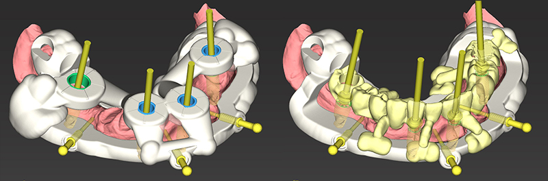 Fig-46-47