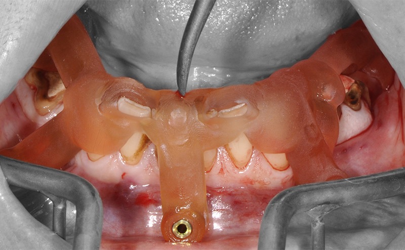 Fig-50