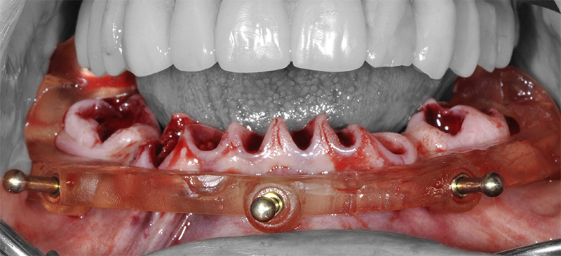 Fig-51