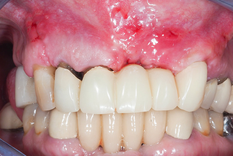 Sutures-J-14-27