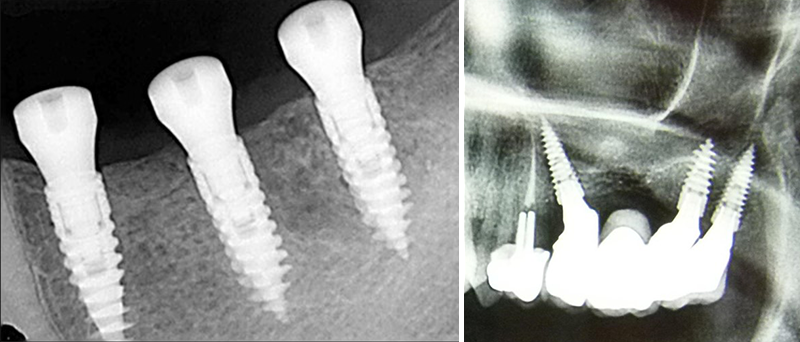 Fig.01-02-paroles-dexperts-3