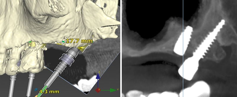 Fig.03-04-paroles-dexperts-3