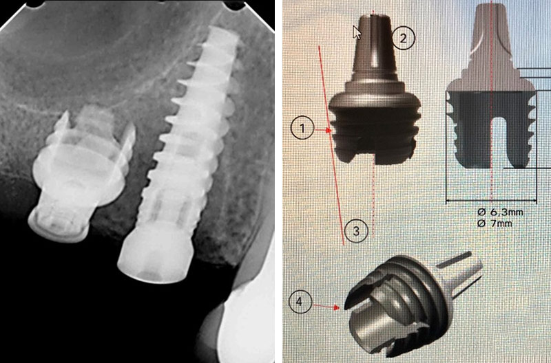 Fig.09-10