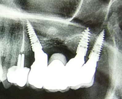 Fig.13-paroles-dexperts-3