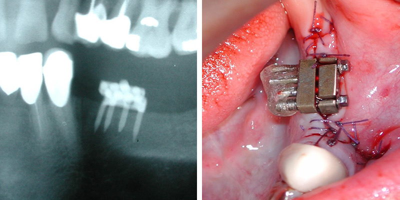 Fig.16-17-paroles-dexperts-3