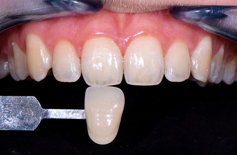 Image-3-teinte