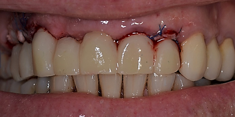 2-Fig06-Karsenti