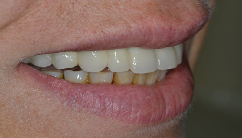 2-Fig10-Karsenti