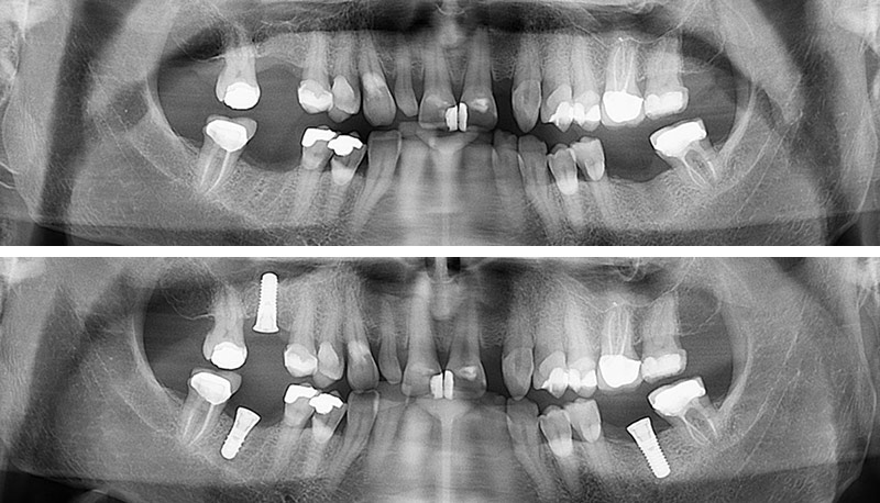 2-Fig13-Radiographies-Karsenti