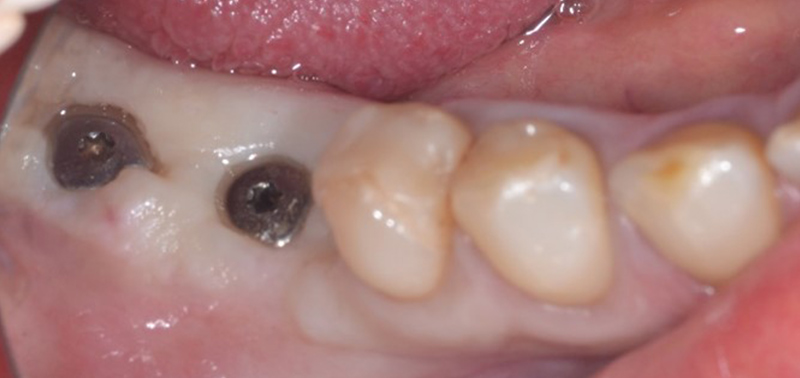 2-Fig14-Karsenti