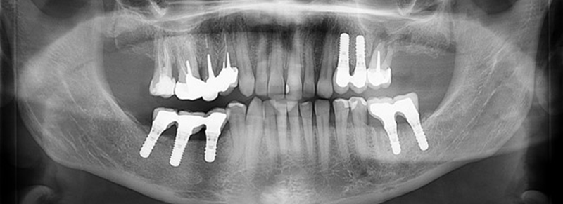 2-Fig15-Radiographie