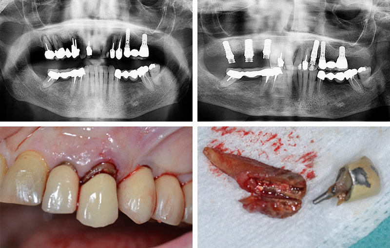 2-Fig16-Karsenti