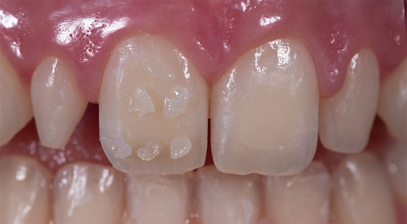 figure2_BD